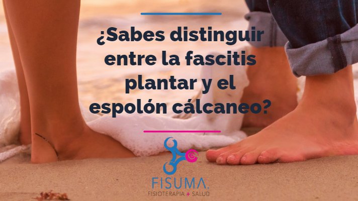 Diferencias entre fascitis plantar y espolón calcáneo