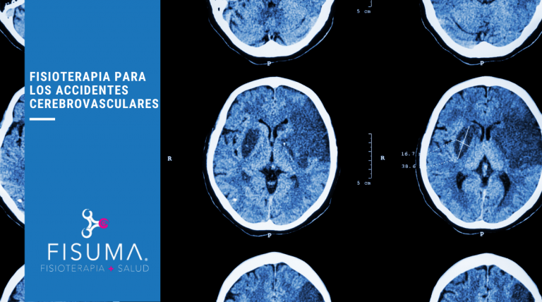 Fisioterapia para accidentes cerebrovasculares