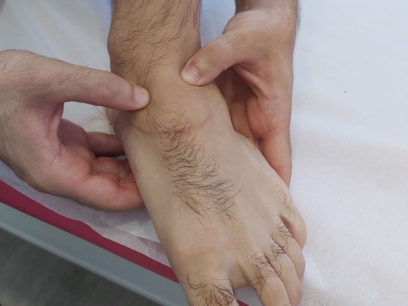 Descubre cuáles son las lesiones del escafoides del pie