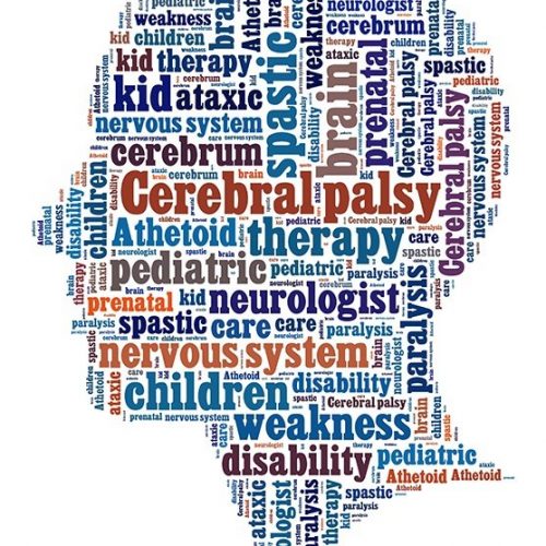 paralisis-cerebral